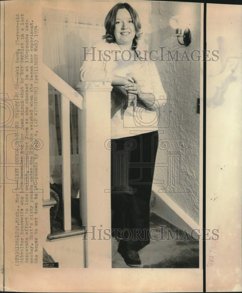 1974 Press Photo Debi Horn had jaws wired shut to lose weight - now17731