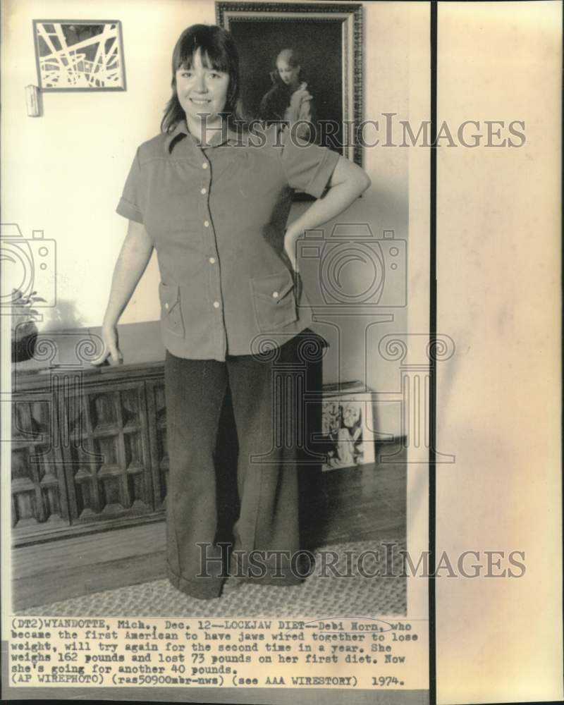 1974 Press Photo Debi Horn, first American to have jaws wired to lose weight