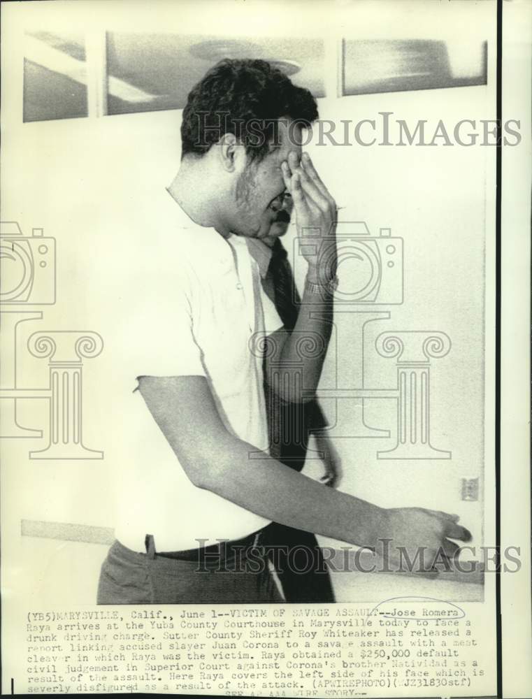 Load image into Gallery viewer, 1971 Press Photo Victim of savage attack Jose Romera arrested on DUI charge
