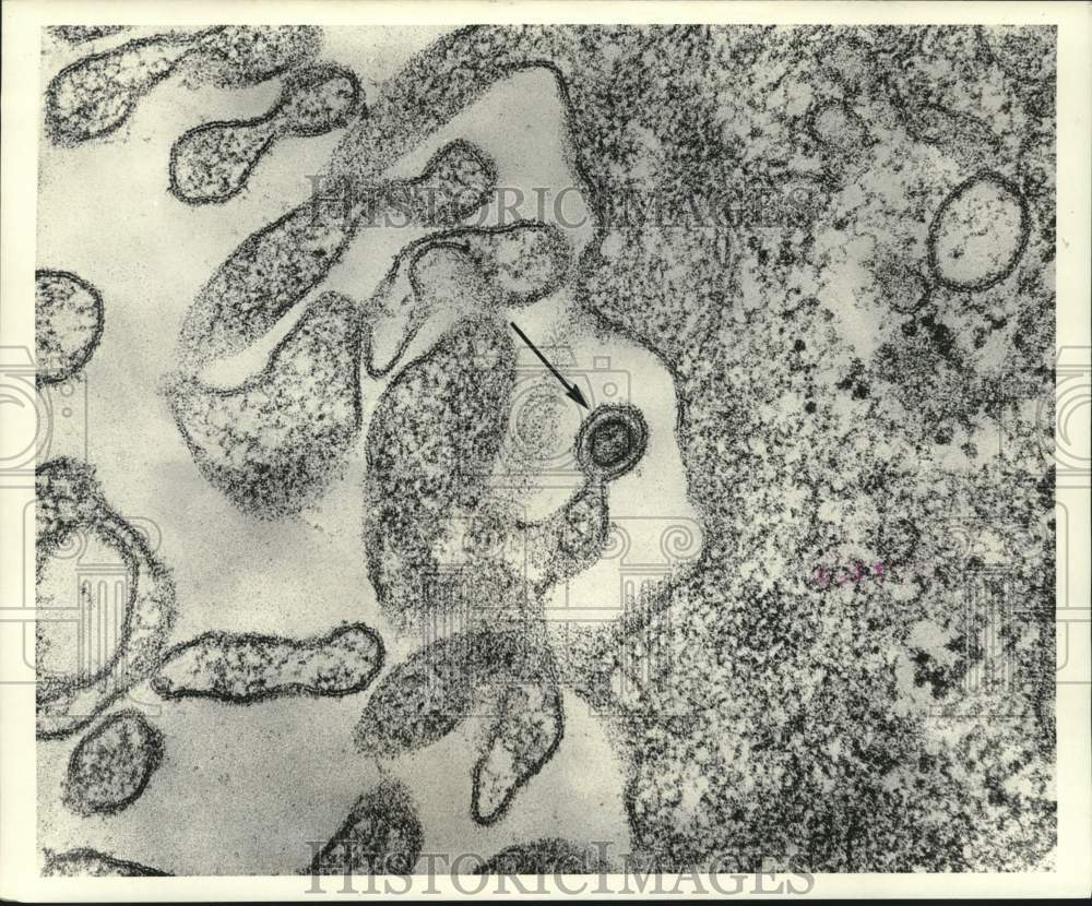 1969 Press Photo Mouse leukemia virus magnified 150,000 by electron microscope