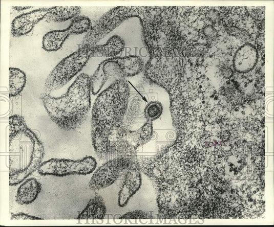 1969 Press Photo Mouse leukemia virus magnified 150,000 by electron microscope