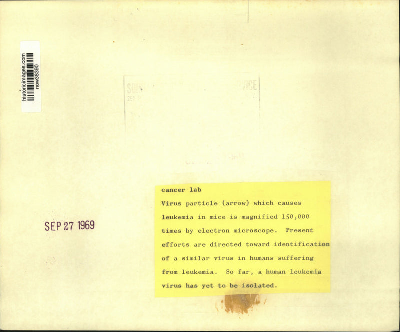 Load image into Gallery viewer, 1969 Press Photo Mouse leukemia virus magnified 150,000 by electron microscope

