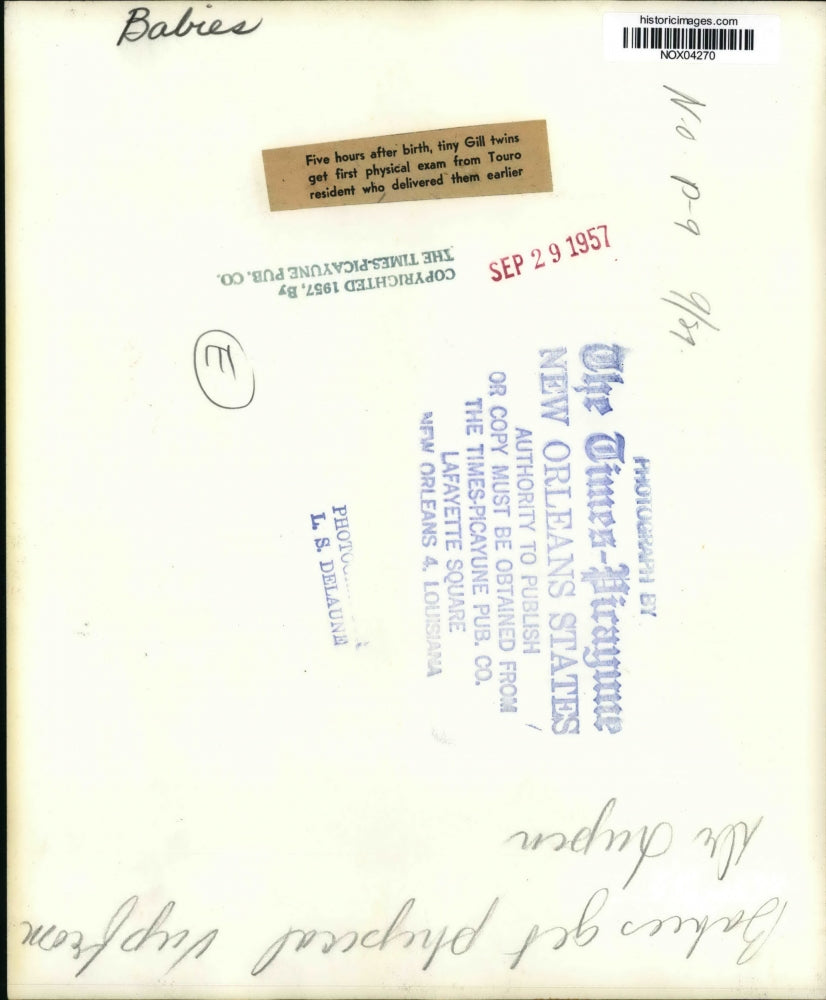 1957 Press Photo Touro resident doctor examines tiny Gill twins after birth.