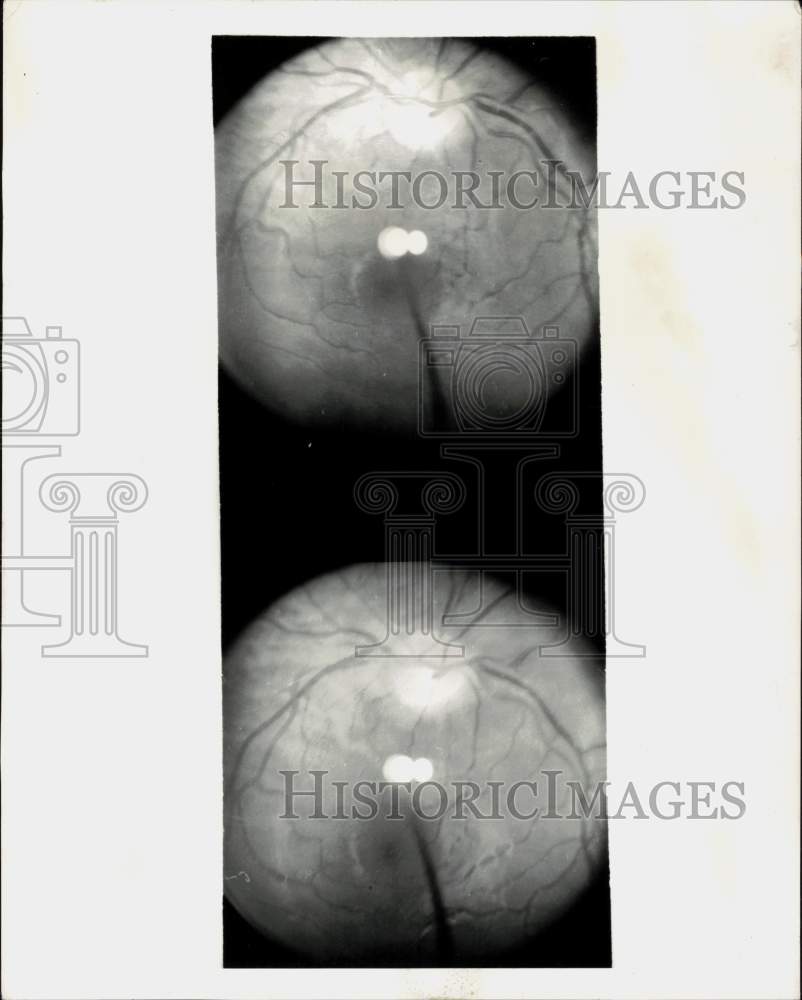 1950 Press Photo Close-up view of the eyes - pia10483