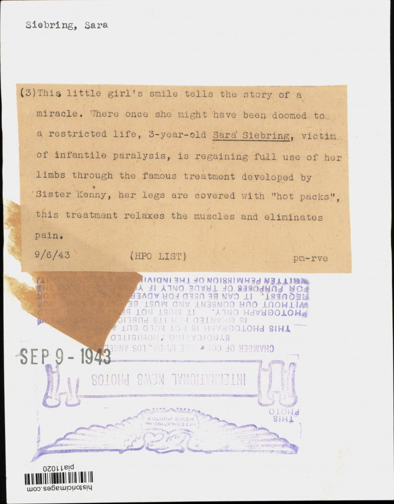 1943 Press Photo Sara Siebring's legs treated by Sister Kenny's "hot packs"