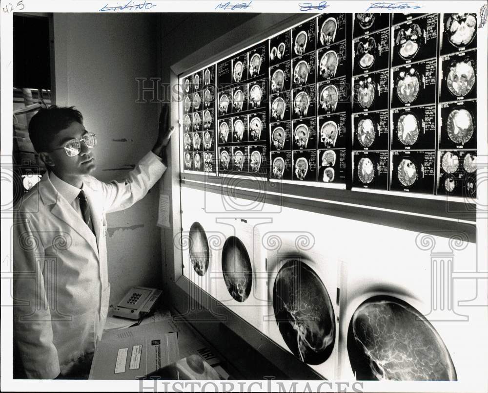 1991 Press Photo Dr. Jagannath with MRI Scans of Brain Cancer - pna05042- Historic Images