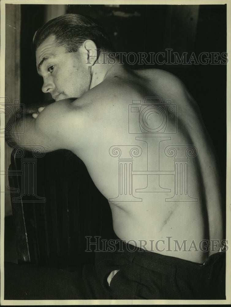 1935 Press Photo UCLA fullback RF Ted Key Showing a Scar on His Back - sba25168