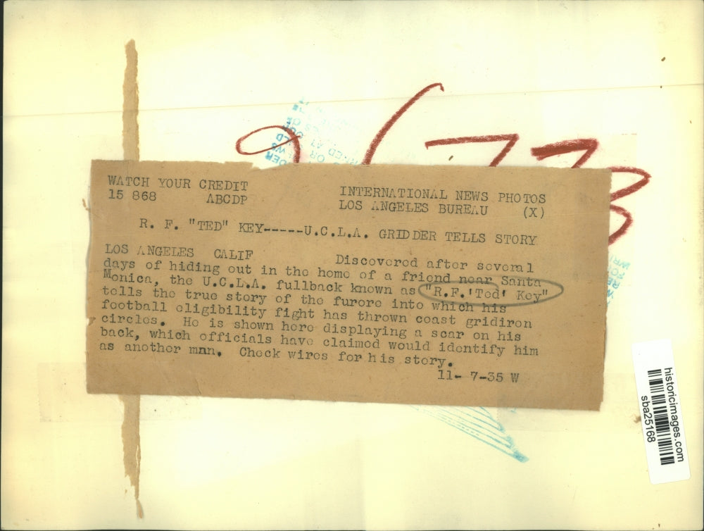 1935 Press Photo UCLA fullback RF Ted Key Showing a Scar on His Back - sba25168