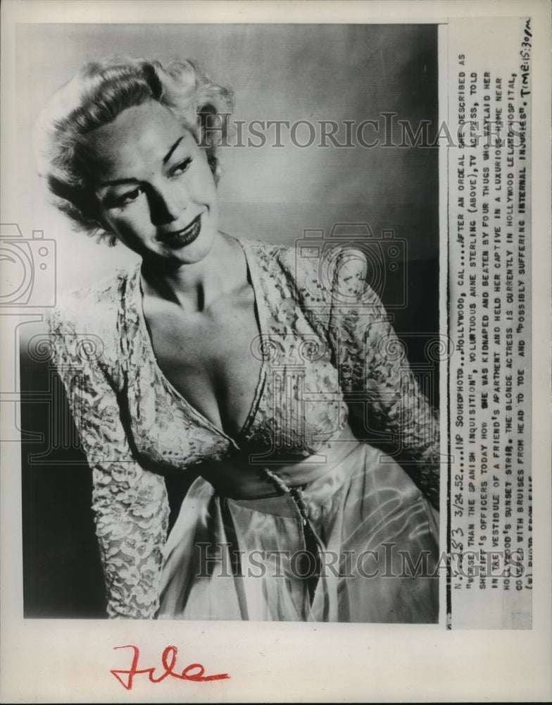 1952 Press Photo Anne Sterling TV actress after kidnap & assault by 4 men