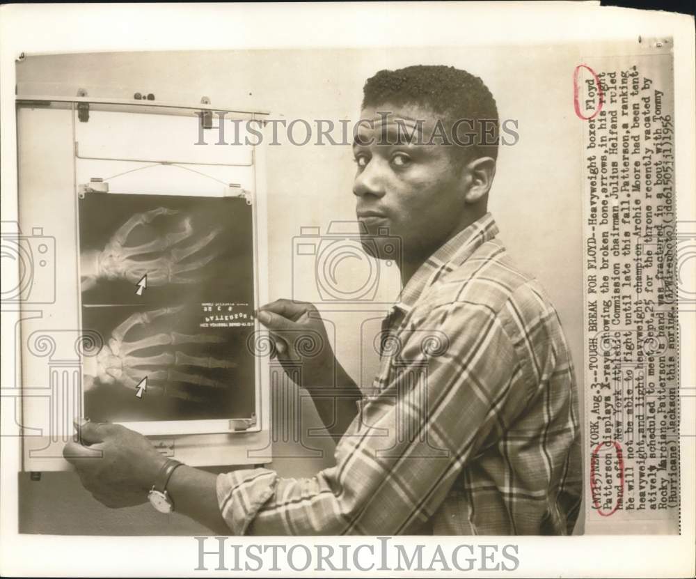 1956 Press Photo Boxer Floyd Patterson displays X-rays in New York of Hand- Historic Images