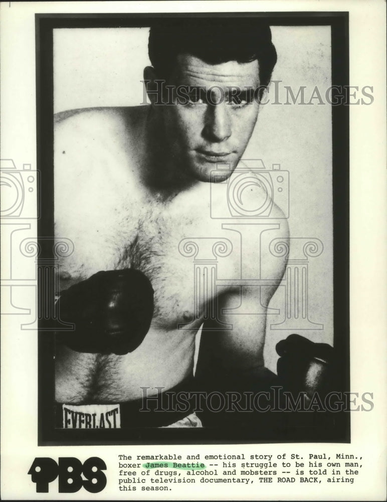 1981 Press Photo Boxer James Beattle has overcome many obstacles - sps01508- Historic Images