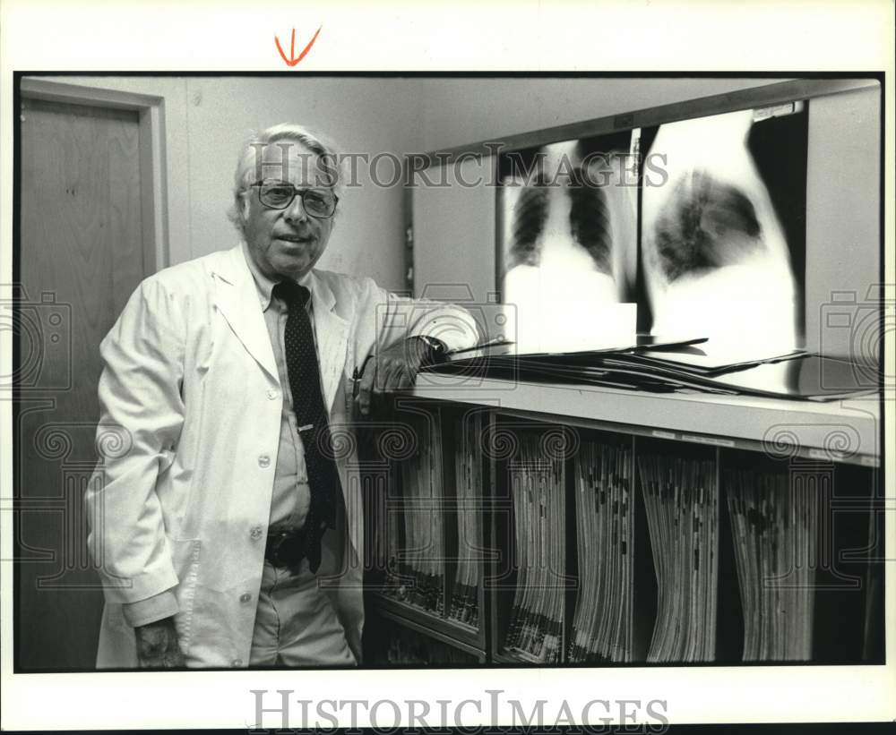 1985 Press Photo Doctor William A. Schiess with Chest X-Rays - sya12537