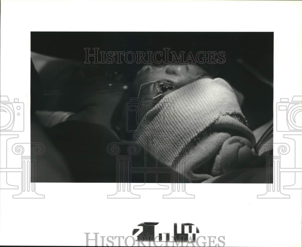 1992 Press Photo Brett Coleman lays under Excimer Laser during eye surgery- Historic Images