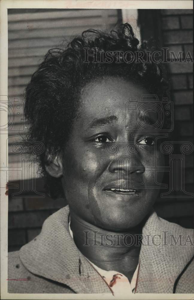 1963 Press Photo Mrs Dolores Young, victim of fire at 70 Park Avenue - tua22168