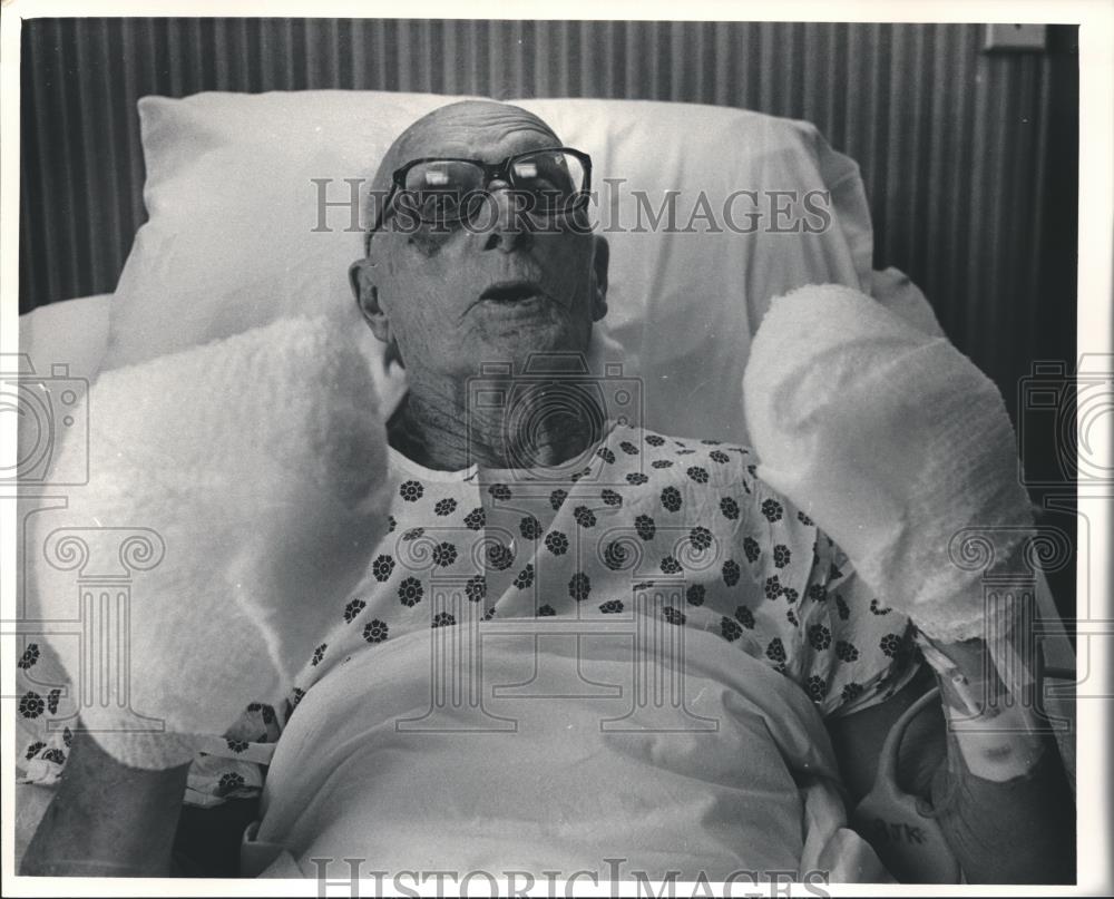 1983 Press Photo Gilbert Luebke, recovers in hospital, Milwaukee, Wisconsin - Historic Images