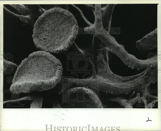 1981 Press Photo Magnified photo 40 times of species Teloschistes - mja95697 - Historic Images