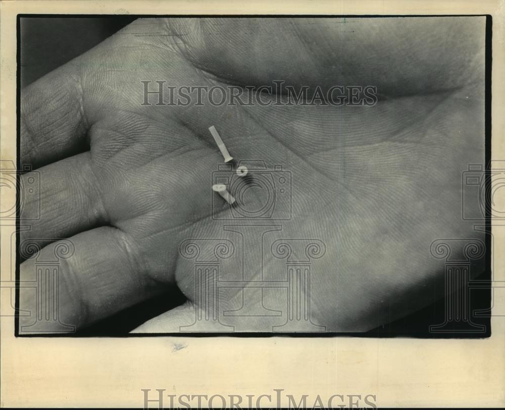 1984 Press Photo Tubes for the ears of small children prone to ear infections - Historic Images