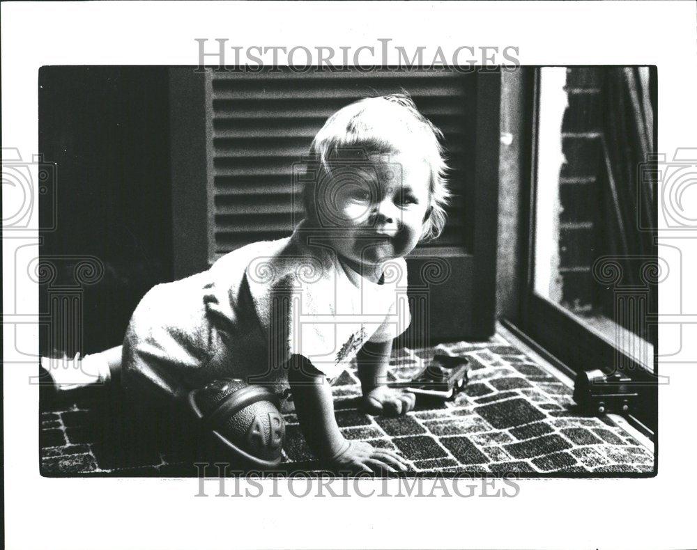 1983 Press Photo Scott Topskiliver transplant baby - RRV54079 - Historic Images