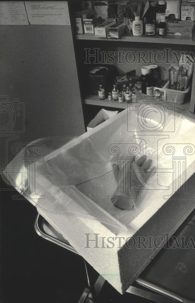 1985 Press Photo Froedtert Hospital&#39;s special box for preserving body parts - Historic Images