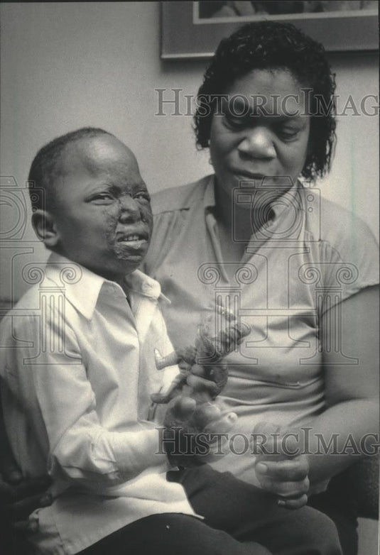 1986 Press Photo Robert Kelly, burn victim at St. Mary's Hospital - mjb75535 - Historic Images