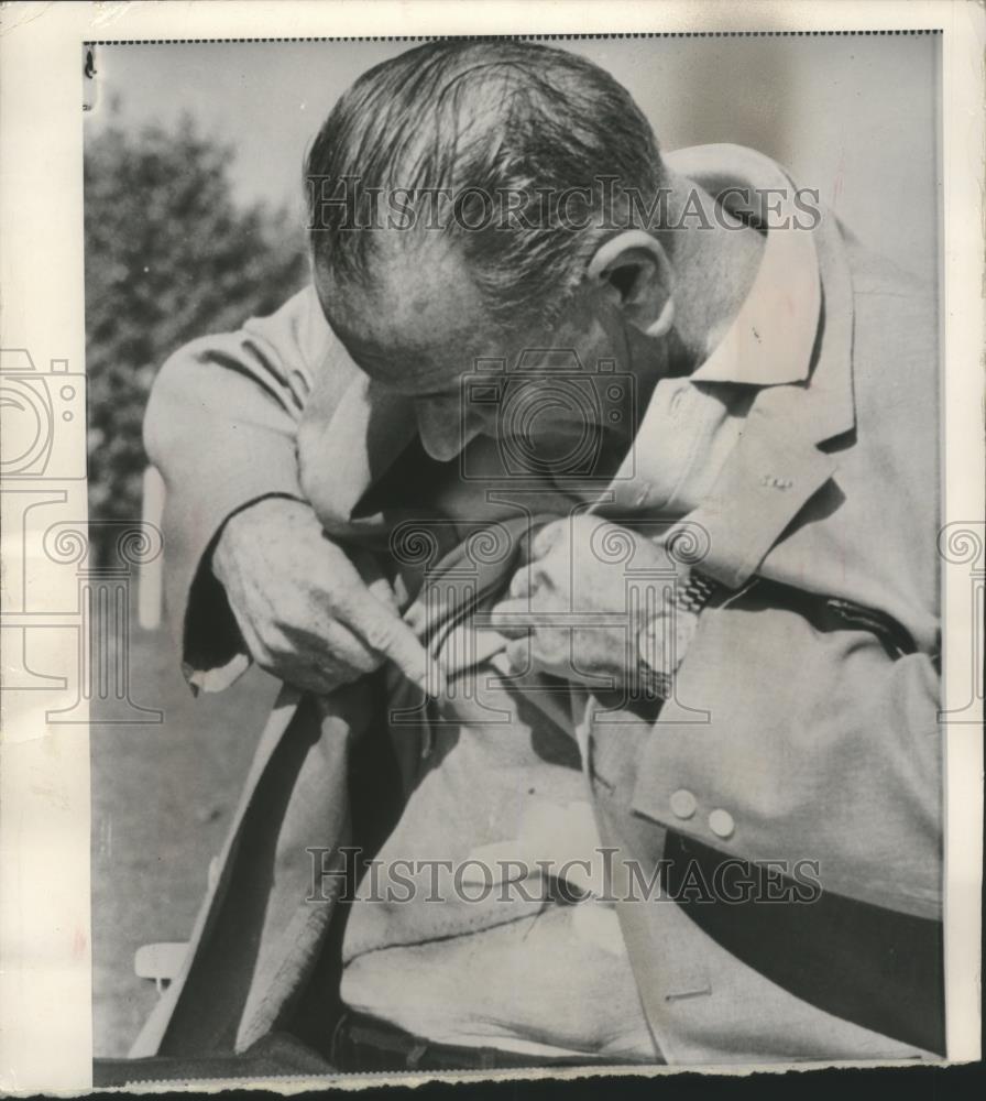 1985 Press Photo President Johnson shows his scar at Bethesda Naval Hospital - Historic Images