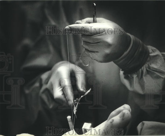 1983 Press Photo Surgeon's hands operating to save a foot, Milwuaukee - Historic Images