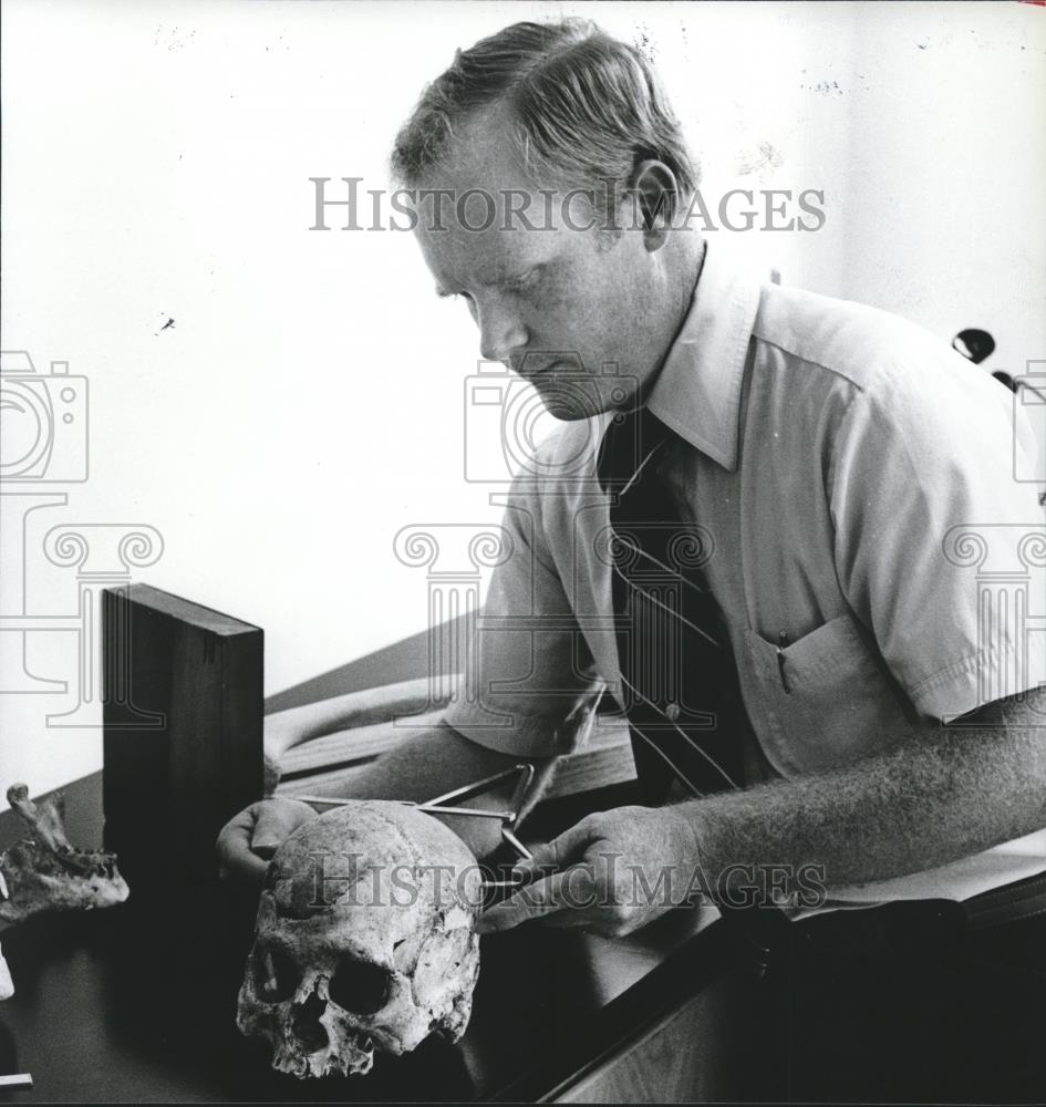 1981 Press Photo Doctor Ken Turner, University of Alabama, Human Osteology - Historic Images