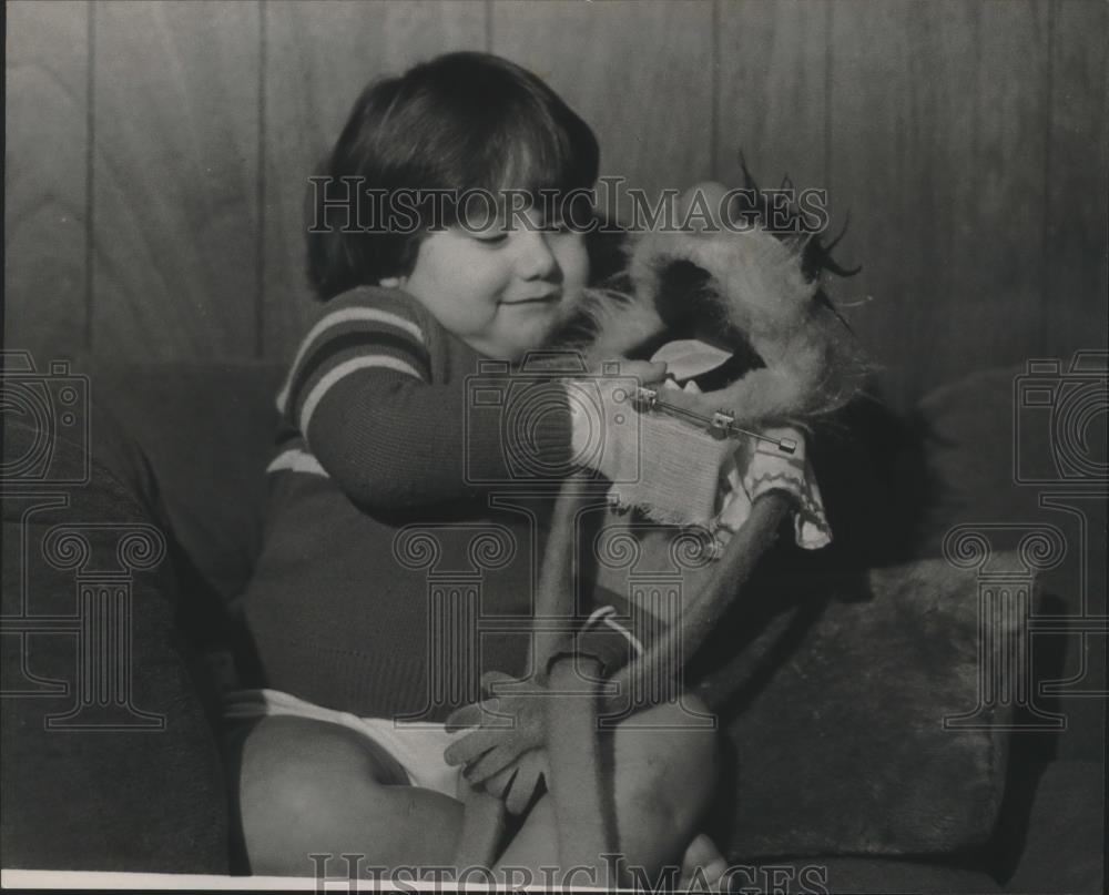 1984 Press Photo Jay McGiboney Gets New Fingers Through Surgery, Alabama - Historic Images