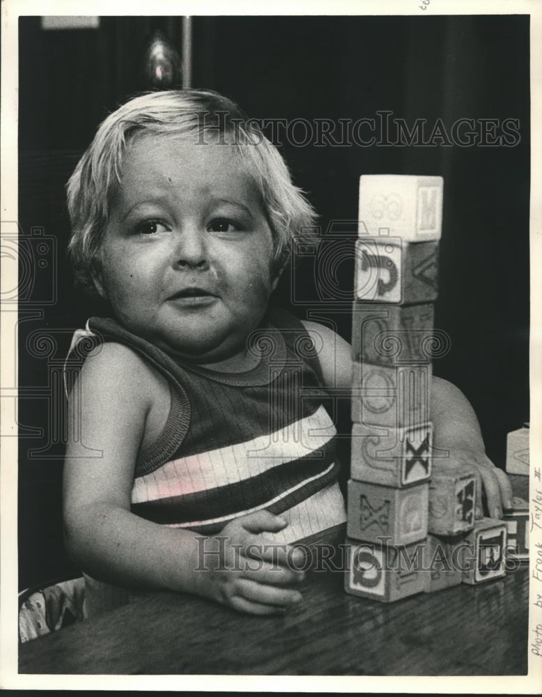 1982 Press Photo Liver Transplant Patient Brian White - abna29328 - Historic Images