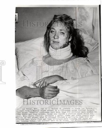 1965 Press Photo Linda Lee Barnum mauled leopard - Historic Images