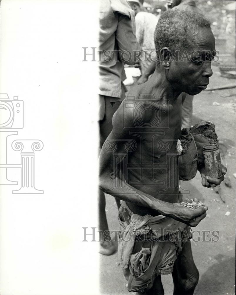 Press Photo Nigeria: The Face and figure of hunger Pove and Misery. - Historic Images