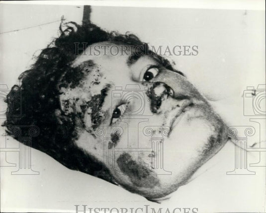 1975 Press Photo More Than 40 people Feared Dead In Avalanches In The Alps - Historic Images
