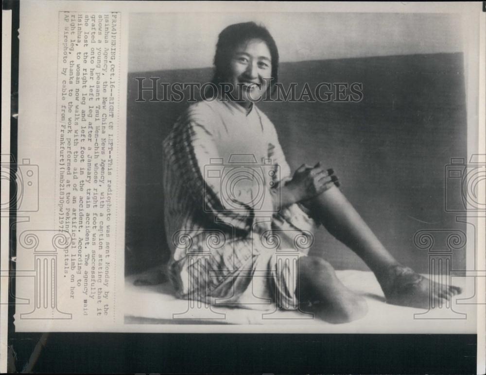 1972 Press Photo Tsui Wen-Chih, removed right foot after a Train accident - Historic Images