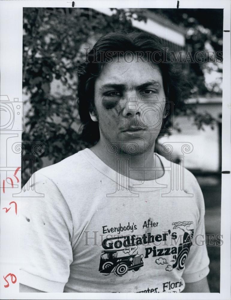 1981 Press Photo Patrick R Osbon, Claimed Beaten by Jail Officers in Clearwater - Historic Images