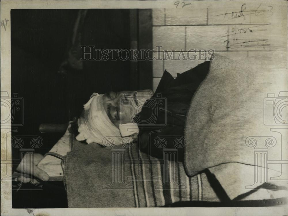 1951 Press Photo Officer Francis McKenna Jr Injured Hit & Run - RSL06939 - Historic Images