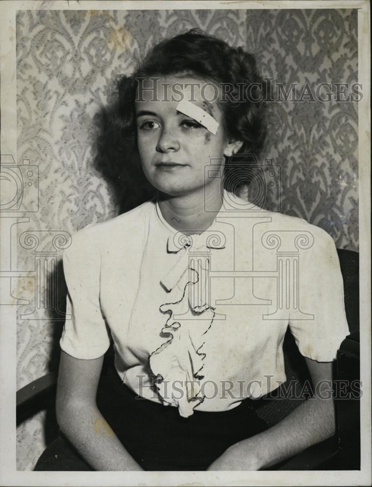 1946 Press Photo Jeannette Cole Of Gordon Injured In A Hit-And-Run - RSL42035 - Historic Images