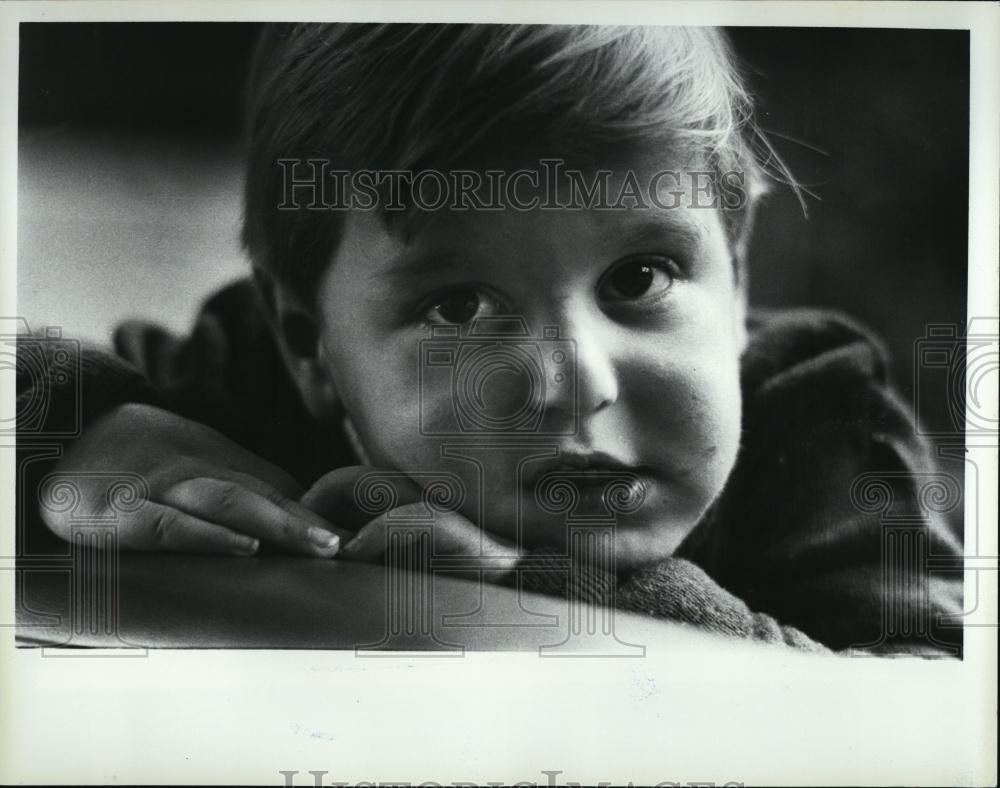 1984 Press Photo Baby Billy Banghart, Patient at Boston Children&#39;s Hospital - Historic Images