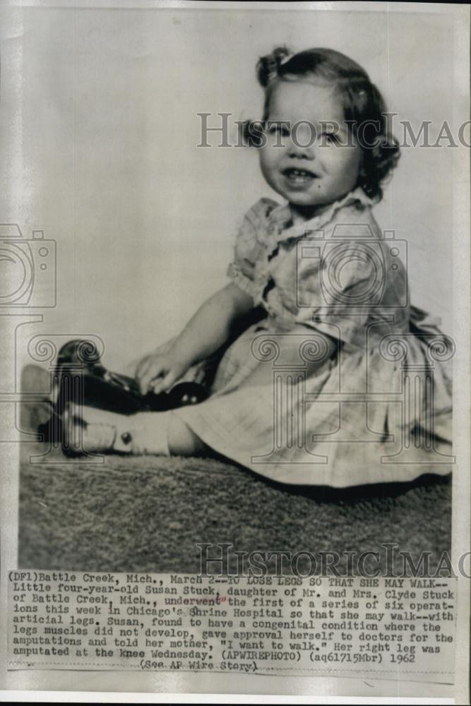 1962 Press Photo Susan Stuck Congenital condition Surgeries - RSL63541 - Historic Images