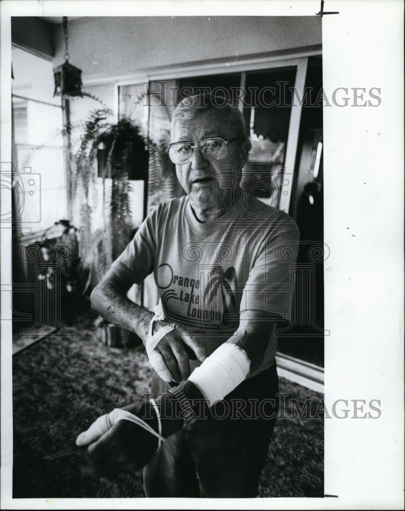 1988 Press Photo Andrew Zarlinski bitten hands arm dog attacked pit bull - Historic Images