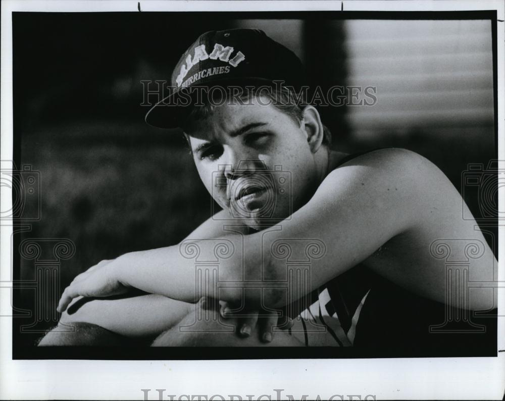 1991 Press Photo Sean William After Reconstructive Surgery - RSL97691 - Historic Images