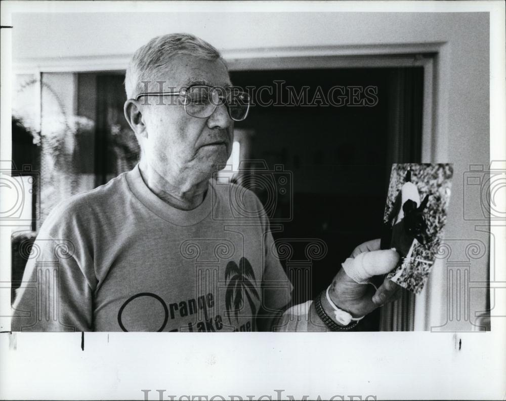 1988 Press Photo Andrew Zarlinski Attacked By Pit Bull - RSL97407 - Historic Images