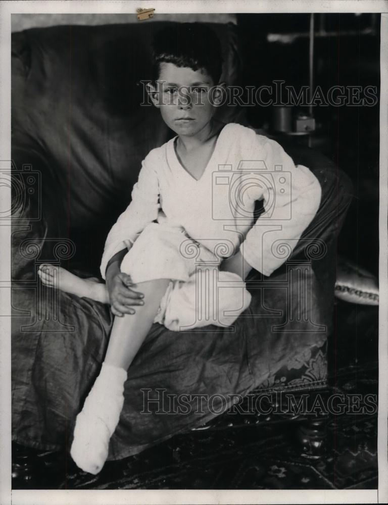 Press Photo Alfred Maskell, 7, burned foot in peat fire near Baldwin Hills - Historic Images