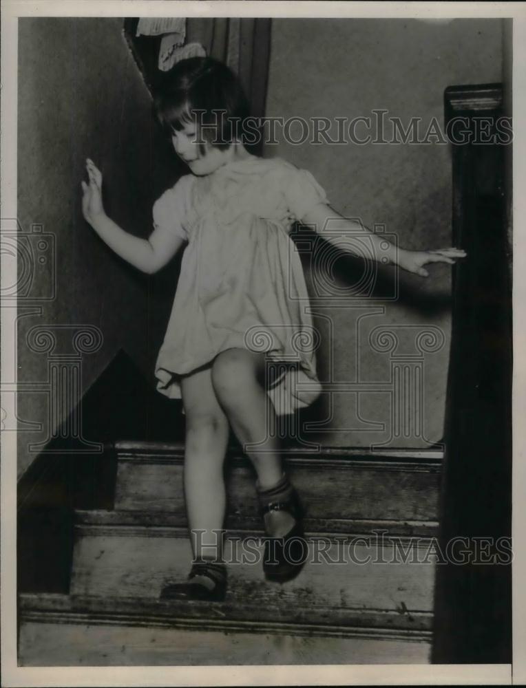 1938 Press Photo Alice Louise Querry age 5 lost eye to Glioma cancerous growth - Historic Images