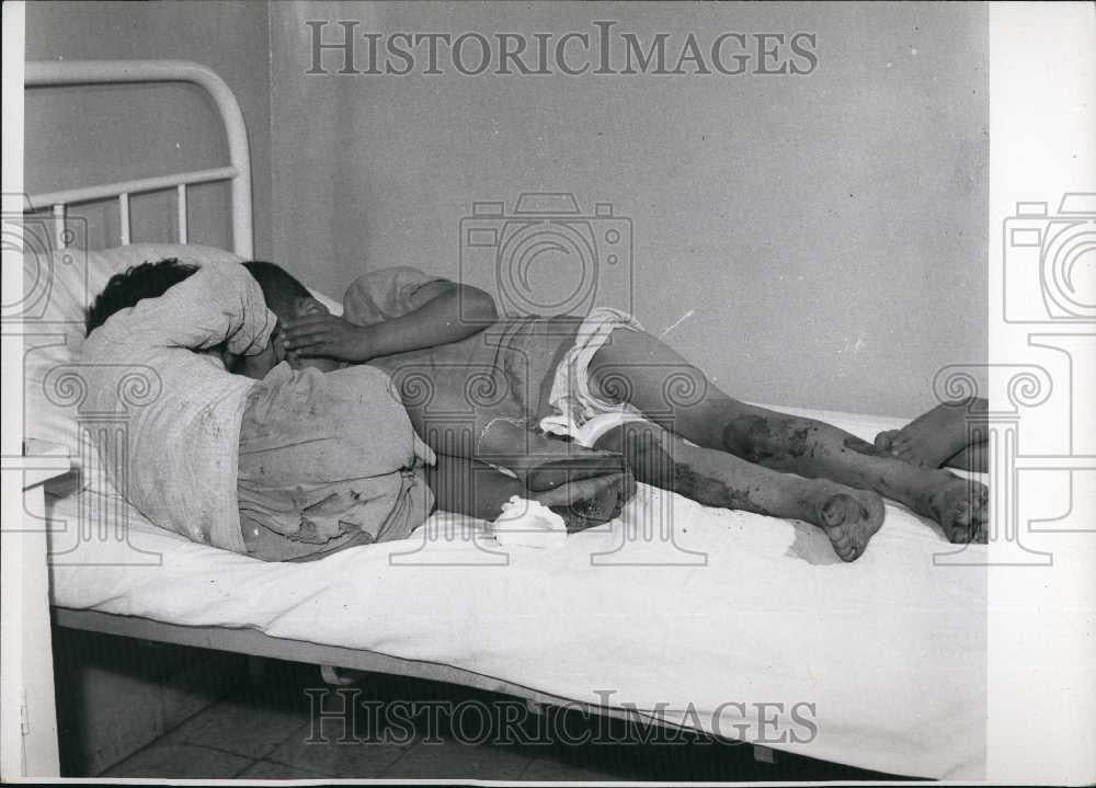 Press Photo Injured Children in Hospital Bed - Historic Images