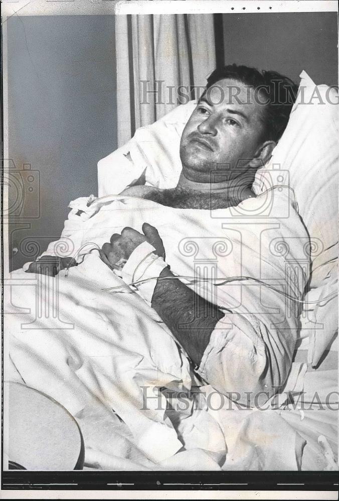 1962 Press Photo William Admich Laying In Hospital Bed After Being Burned - Historic Images