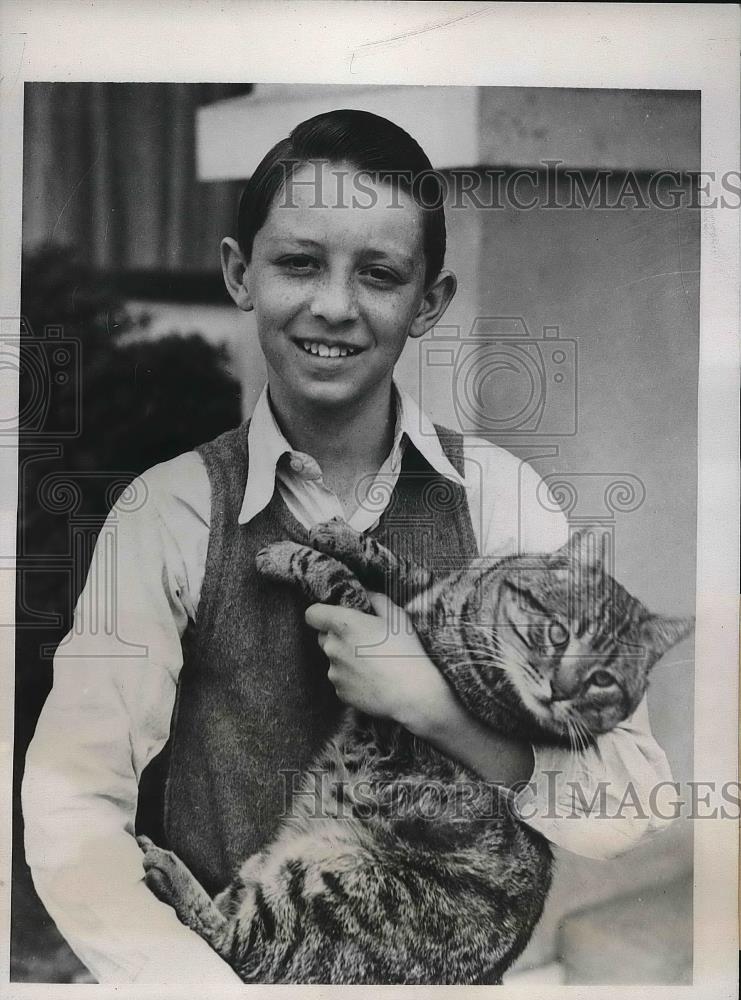 1935 Press Photo jimmy Nellson of San Jose Calif boy with upside Stomach. - Historic Images