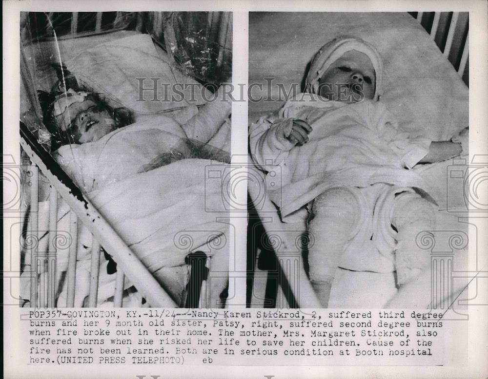 1952 Press Photo Nancy Karen Stickrod Suffered 3rd Degree Burns &amp; Sister Patsy - Historic Images