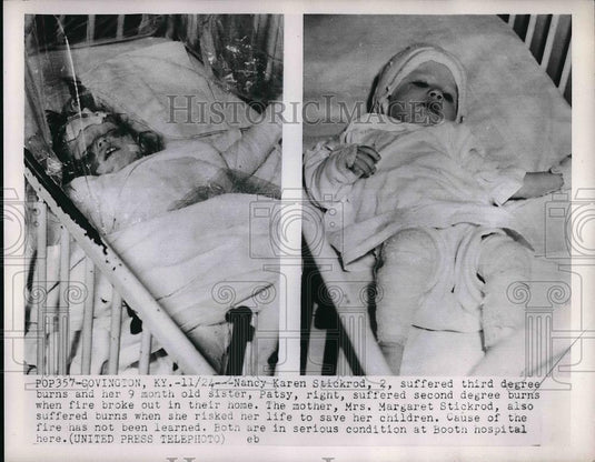1952 Press Photo Nancy Karen Stickrod Suffered 3rd Degree Burns & Sister Patsy - Historic Images