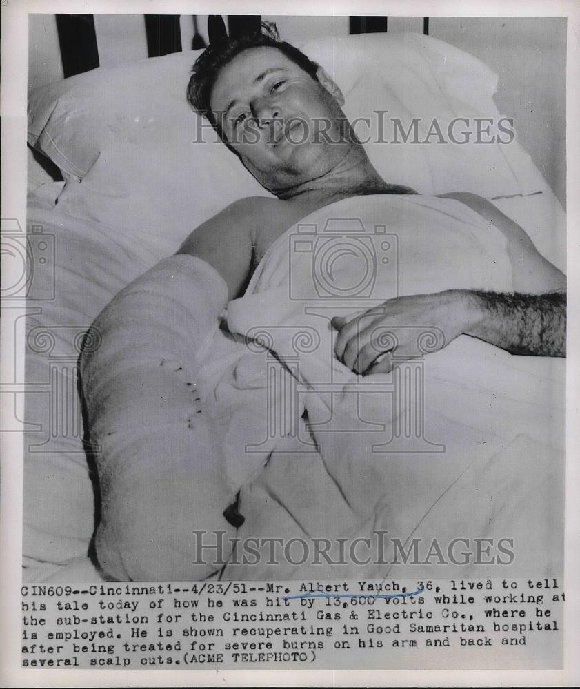 1951 Press Photo Mr. Albert Yauch hit by 13,600 volts Sub station - Historic Images