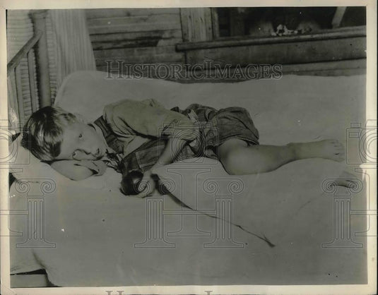 1934 Press Photo Infected Swollen Leg of Wallace Doyle Sharp Jr. - Historic Images